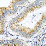 alpha COP Antibody in Immunohistochemistry (Paraffin) (IHC (P))