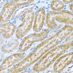 alpha COP Antibody in Immunohistochemistry (Paraffin) (IHC (P))