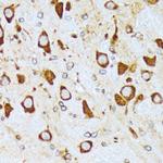 alpha COP Antibody in Immunohistochemistry (Paraffin) (IHC (P))