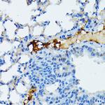 Fibrinogen alpha chain Antibody in Immunohistochemistry (Paraffin) (IHC (P))