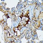 Fibrinogen alpha chain Antibody in Immunohistochemistry (Paraffin) (IHC (P))