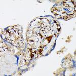 Fibrinogen alpha chain Antibody in Immunohistochemistry (Paraffin) (IHC (P))