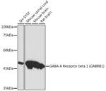 GABRB1 Antibody in Western Blot (WB)