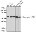 Hippocalcin Antibody in Western Blot (WB)