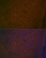 HTR7 Antibody in Immunohistochemistry (Paraffin) (IHC (P))