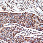 NDUFB8 Antibody in Immunohistochemistry (Paraffin) (IHC (P))