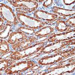 NDUFB8 Antibody in Immunohistochemistry (Paraffin) (IHC (P))