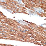 NDUFB8 Antibody in Immunohistochemistry (Paraffin) (IHC (P))