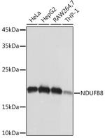 NDUFB8 Antibody in Western Blot (WB)