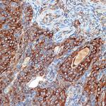 PRKAR2B Antibody in Immunohistochemistry (Paraffin) (IHC (P))