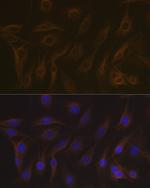 MAPRE3 Antibody in Immunocytochemistry (ICC/IF)