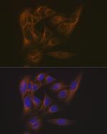 MAPRE3 Antibody in Immunocytochemistry (ICC/IF)