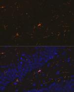 IBA1 Antibody in Immunohistochemistry (Paraffin) (IHC (P))