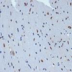 UNC84B Antibody in Immunohistochemistry (Paraffin) (IHC (P))