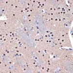 BCL11B Antibody in Immunohistochemistry (Paraffin) (IHC (P))