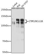 BCL11B Antibody in Western Blot (WB)