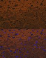 Syntaxin 1 Antibody in Immunocytochemistry (ICC/IF)