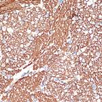 Syntaxin 1 Antibody in Immunohistochemistry (Paraffin) (IHC (P))