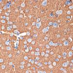 Syntaxin 1 Antibody in Immunohistochemistry (Paraffin) (IHC (P))