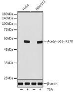 Acetyl-p53 (Lys370) Antibody in Western Blot (WB)