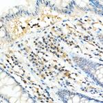 FADD Antibody in Immunohistochemistry (Paraffin) (IHC (P))