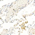 FADD Antibody in Immunohistochemistry (Paraffin) (IHC (P))