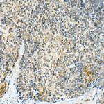 FADD Antibody in Immunohistochemistry (Paraffin) (IHC (P))