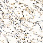 FADD Antibody in Immunohistochemistry (Paraffin) (IHC (P))