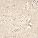 BAP31 Antibody in Immunohistochemistry (Paraffin) (IHC (P))