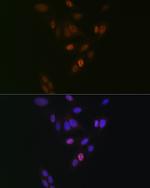 NUP153 Antibody in Immunocytochemistry (ICC/IF)