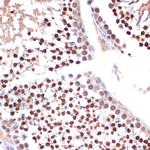 NUP153 Antibody in Immunohistochemistry (Paraffin) (IHC (P))