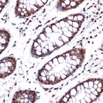 NUP153 Antibody in Immunohistochemistry (Paraffin) (IHC (P))