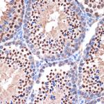 NUP153 Antibody in Immunohistochemistry (Paraffin) (IHC (P))