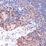 ALOX5 Antibody in Immunohistochemistry (Paraffin) (IHC (P))