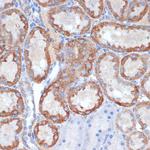 CLPP Antibody in Immunohistochemistry (Paraffin) (IHC (P))