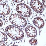 CLPP Antibody in Immunohistochemistry (Paraffin) (IHC (P))