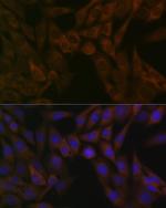 ARF5 Antibody in Immunocytochemistry (ICC/IF)