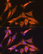 S100A6 Antibody in Immunocytochemistry (ICC/IF)