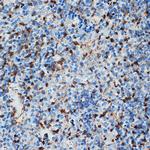 S100A6 Antibody in Immunohistochemistry (Paraffin) (IHC (P))