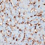 S100A6 Antibody in Immunohistochemistry (Paraffin) (IHC (P))