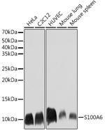 S100A6 Antibody in Western Blot (WB)