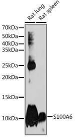 S100A6 Antibody in Western Blot (WB)