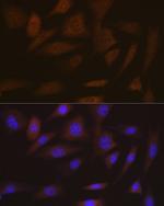 SMC4 Antibody in Immunocytochemistry (ICC/IF)