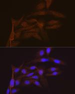 SMC4 Antibody in Immunocytochemistry (ICC/IF)