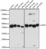 ATF5 Antibody in Western Blot (WB)