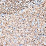 alpha Internexin Antibody in Immunohistochemistry (Paraffin) (IHC (P))