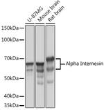 alpha Internexin Antibody in Western Blot (WB)