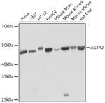 AGTR2 Antibody in Western Blot (WB)