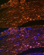 Calponin 1 Antibody in Immunohistochemistry (Paraffin) (IHC (P))