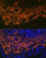 Calponin 1 Antibody in Immunohistochemistry (Paraffin) (IHC (P))